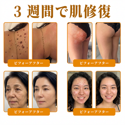 🐝皮膚科学的および臨床的にテスト済み👩‍⚕️APKAPK™ 蜂毒 (ハチドク)   肌再生クリーム🐝 シワ、傷跡、色素沈着、妊娠線、ニキビ、乾癬、湿疹、皮膚の変調、刺激、炎症、その他の皮膚トラブルといった問題の治療に役立ちます🎈