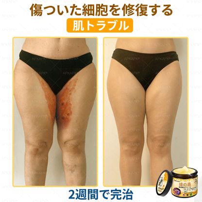 🐝皮膚科学的および臨床的にテスト済み👩‍⚕️APKAPK™ 蜂毒 (ハチドク)   肌再生クリーム🐝 シワ、傷跡、色素沈着、妊娠線、ニキビ、乾癬、湿疹、皮膚の変調、刺激、炎症、その他の皮膚トラブルといった問題の治療に役立ちます🎈
