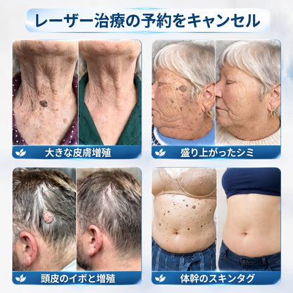 🍧公式ブランドストア  𝐏i𝐜𝐝o® 𝟕日間イボ&シミ消し(痛みも傷跡もゼロのローラーボール)