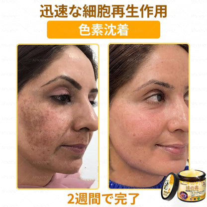 🐝皮膚科学的および臨床的にテスト済み👩‍⚕️APKAPK™ 蜂毒 (ハチドク)   肌再生クリーム🐝 シワ、傷跡、色素沈着、妊娠線、ニキビ、乾癬、湿疹、皮膚の変調、刺激、炎症、その他の皮膚トラブルといった問題の治療に役立ちます🎈