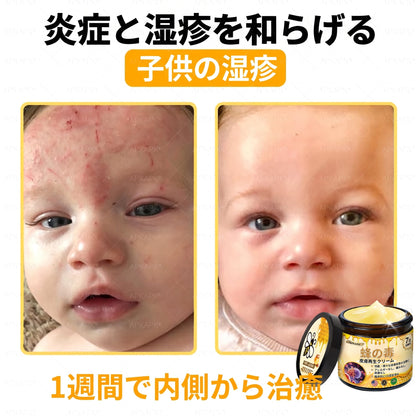 🐝皮膚科学的および臨床的にテスト済み👩‍⚕️APKAPK™ 蜂毒 (ハチドク)   肌再生クリーム🐝 シワ、傷跡、色素沈着、妊娠線、ニキビ、乾癬、湿疹、皮膚の変調、刺激、炎症、その他の皮膚トラブルといった問題の治療に役立ちます🎈