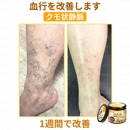 🐝皮膚科学的および臨床的にテスト済み👩‍⚕️APKAPK™ 蜂毒 (ハチドク)   肌再生クリーム🐝 シワ、傷跡、色素沈着、妊娠線、ニキビ、乾癬、湿疹、皮膚の変調、刺激、炎症、その他の皮膚トラブルといった問題の治療に役立ちます🎈