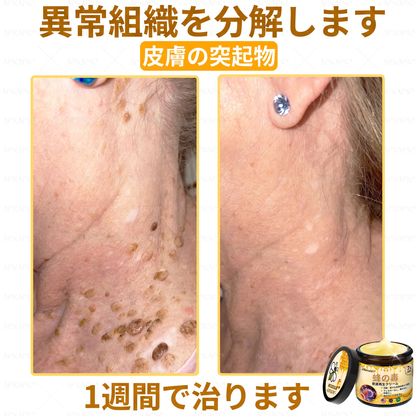🐝皮膚科学的および臨床的にテスト済み👩‍⚕️APKAPK™ 蜂毒 (ハチドク)   肌再生クリーム🐝 シワ、傷跡、色素沈着、妊娠線、ニキビ、乾癬、湿疹、皮膚の変調、刺激、炎症、その他の皮膚トラブルといった問題の治療に役立ちます🎈