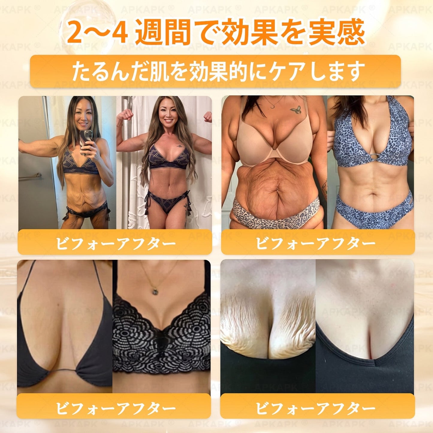 🐝皮膚科学的および臨床的にテスト済み👩‍⚕️APKAPK™ 蜂毒 (ハチドク)   肌再生クリーム🐝 シワ、傷跡、色素沈着、妊娠線、ニキビ、乾癬、湿疹、皮膚の変調、刺激、炎症、その他の皮膚トラブルといった問題の治療に役立ちます🎈