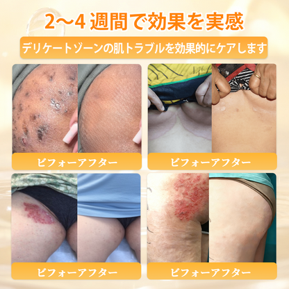 🐝皮膚科学的および臨床的にテスト済み👩‍⚕️APKAPK™ 蜂毒 (ハチドク)   肌再生クリーム🐝 シワ、傷跡、色素沈着、妊娠線、ニキビ、乾癬、湿疹、皮膚の変調、刺激、炎症、その他の皮膚トラブルといった問題の治療に役立ちます🎈