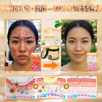 🐝皮膚科学的および臨床的にテスト済み👩‍⚕️APKAPK™ 蜂毒 (ハチドク)   肌再生クリーム🐝 シワ、傷跡、色素沈着、妊娠線、ニキビ、乾癬、湿疹、皮膚の変調、刺激、炎症、その他の皮膚トラブルといった問題の治療に役立ちます🎈