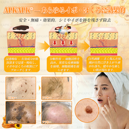 🐝皮膚科学的および臨床的にテスト済み👩‍⚕️APKAPK™ 蜂毒 (ハチドク)   肌再生クリーム🐝 シワ、傷跡、色素沈着、妊娠線、ニキビ、乾癬、湿疹、皮膚の変調、刺激、炎症、その他の皮膚トラブルといった問題の治療に役立ちます🎈